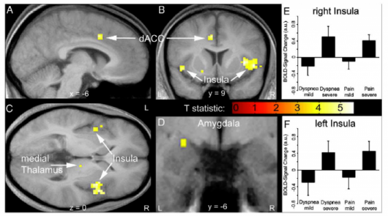 von Leopoldt etal 2009 Fig 3