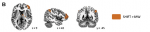 Hasenkamp etal 2012 Fig 2B