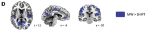 Hasenkamp etal 2012 Fig 2D