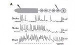 Mullins et al 2011 Fig 5 top