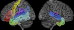 Specht Speech comprehension 2014 Fig 1
